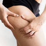Cellulite, cos'è, cause e rimedi